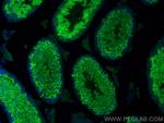 LRRC50 Antibody in Immunohistochemistry (PFA fixed) (IHC (PFA))