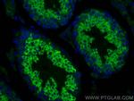 LRRC50 Antibody in Immunohistochemistry (PFA fixed) (IHC (PFA))