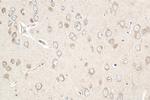 FBXO44 Antibody in Immunohistochemistry (Paraffin) (IHC (P))