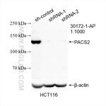 PACS2 Antibody in Western Blot (WB)