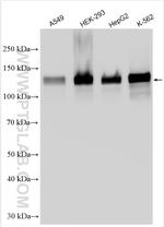 LATS1 Antibody in Western Blot (WB)