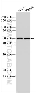 Ribosomal protein L4 Antibody in Western Blot (WB)