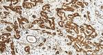 LASS2 Antibody in Immunohistochemistry (Paraffin) (IHC (P))