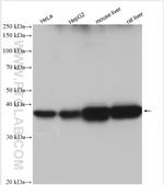 LASS2 Antibody in Western Blot (WB)