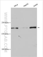TASOR Antibody in Western Blot (WB)