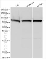 FATS Antibody in Western Blot (WB)