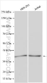 PDZD2 Antibody in Western Blot (WB)