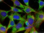 SMPD1, ASM Antibody in Immunocytochemistry (ICC/IF)