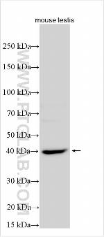 SMPD1, ASM Antibody in Western Blot (WB)
