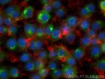 Osteopontin Antibody in Immunocytochemistry (ICC/IF)