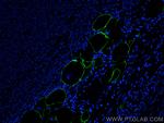 E-selectin/CD62E Antibody in Immunohistochemistry (PFA fixed) (IHC (PFA))
