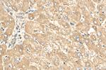 CEP162 Antibody in Immunohistochemistry (Paraffin) (IHC (P))