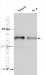 CEP162 Antibody in Western Blot (WB)