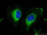 SLC7A8 Antibody in Immunocytochemistry (ICC/IF)