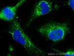 BRAWNIN Antibody in Immunocytochemistry (ICC/IF)