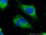 BRAWNIN Antibody in Immunocytochemistry (ICC/IF)