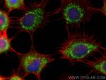BRAWNIN Antibody in Immunocytochemistry (ICC/IF)