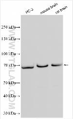 NGEF Antibody in Western Blot (WB)