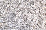 QRICH1 Antibody in Immunohistochemistry (Paraffin) (IHC (P))