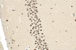 QRICH1 Antibody in Immunohistochemistry (Paraffin) (IHC (P))