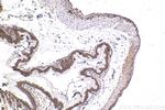 QRICH1 Antibody in Immunohistochemistry (Paraffin) (IHC (P))