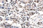 QRICH1 Antibody in Immunohistochemistry (Paraffin) (IHC (P))