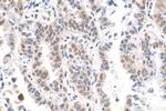 QRICH1 Antibody in Immunohistochemistry (Paraffin) (IHC (P))