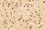 QRICH1 Antibody in Immunohistochemistry (Paraffin) (IHC (P))