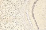 QRICH1 Antibody in Immunohistochemistry (Paraffin) (IHC (P))