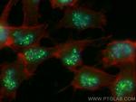 CXorf21 Antibody in Immunocytochemistry (ICC/IF)