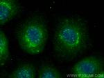 CXorf21 Antibody in Immunocytochemistry (ICC/IF)