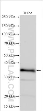 CXorf21 Antibody in Western Blot (WB)