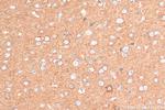 CRTAC1 Antibody in Immunohistochemistry (Paraffin) (IHC (P))