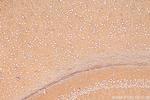 CRTAC1 Antibody in Immunohistochemistry (Paraffin) (IHC (P))