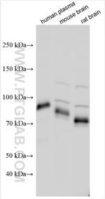 CRTAC1 Antibody in Western Blot (WB)