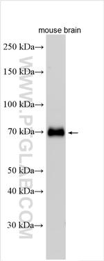 CRTAC1 Antibody in Western Blot (WB)