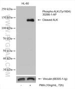 Phospho-ALK (Tyr1604) Antibody in Western Blot (WB)