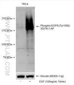 Phospho-EGFR (Tyr1092) Antibody in Western Blot (WB)