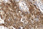 PTPN9 Antibody in Immunohistochemistry (Paraffin) (IHC (P))