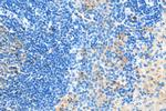 IFN Gamma Antibody in Immunohistochemistry (Paraffin) (IHC (P))