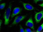 CCBL1 Antibody in Immunocytochemistry (ICC/IF)