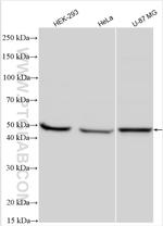 CCBL1 Antibody in Western Blot (WB)