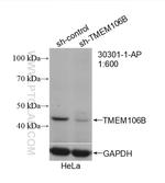 TMEM106B Antibody in Western Blot (WB)