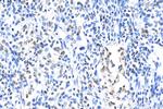 ARID1A Antibody in Immunohistochemistry (Paraffin) (IHC (P))