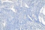ARID1A Antibody in Immunohistochemistry (Paraffin) (IHC (P))