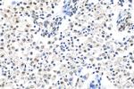 ARID1A Antibody in Immunohistochemistry (Paraffin) (IHC (P))