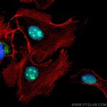 FGF-2 Antibody in Immunocytochemistry (ICC/IF)