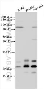 FGF-2 Antibody in Western Blot (WB)