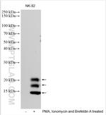 GM-CSF Antibody in Western Blot (WB)