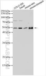 GSDMA Antibody in Western Blot (WB)